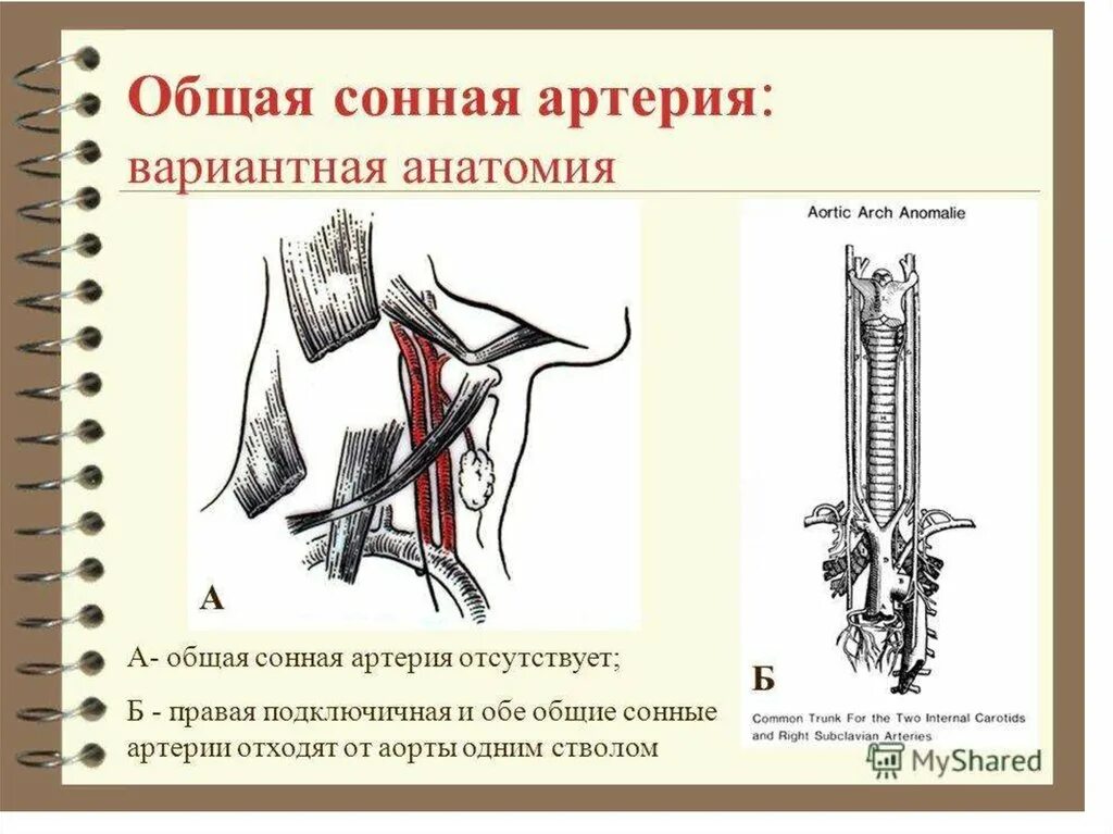 Где находится сонная артерия у мужчин. Сосуды общей сонной артерии. Бифуркация наружной сонной артерии. Место деления общей сонной артерии по Пирогову. Общая Сонная.