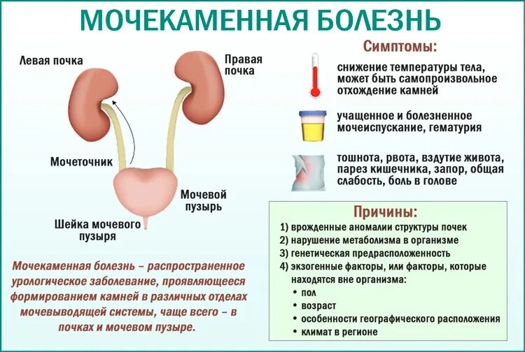 Что может привести к инфекционному заболеванию почек. Заболевания мочевыделительной системы мочекаменная болезнь. Клинические симптомы мочекаменной болезни. Заболевание почек мочекаменная болезнь симптомы. Мочекаменная болезнь причины.