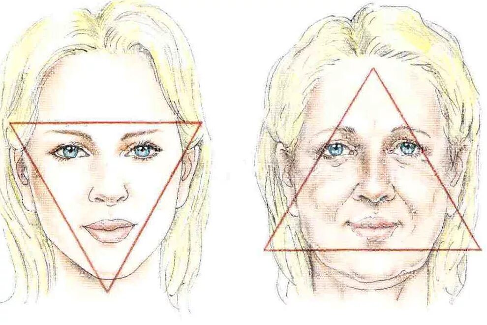 Птоз средней трети лица. Гравитационный птоз лица. Треугольник молодости лица. Треугольное лицо.