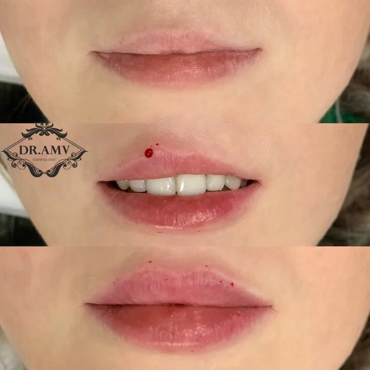 Иваново уролог привалов олег. Минск, ул. Привалов клиника современной медицины. Косметология ленинский проспект. Amv clinic милана арсемикова.