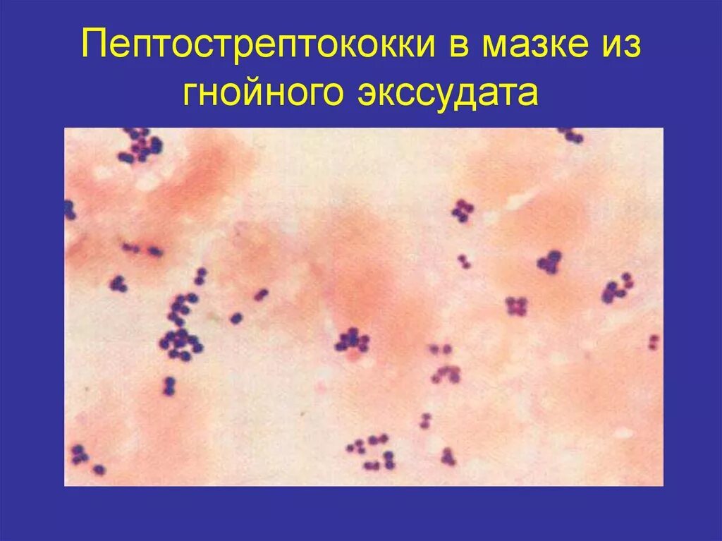Peptostreptococcus. Пептококки и пептострептококки. Морфология пептострептококков. Пептострептококки микробиология. Пептострептококки в полости рта.