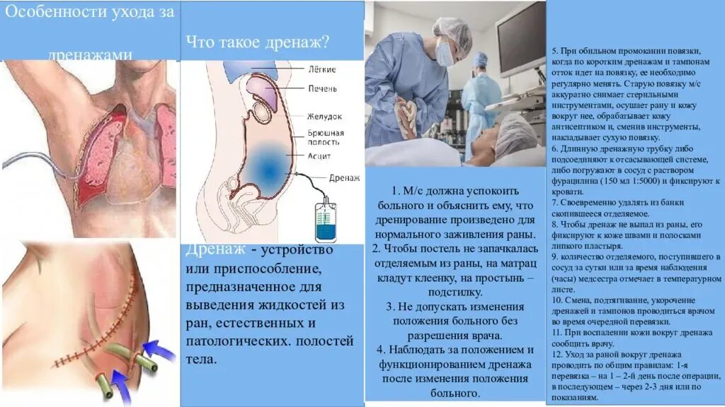 Вернуться после ухода. Особенности ухода за дренажами. Уход за дренажом алгоритм.