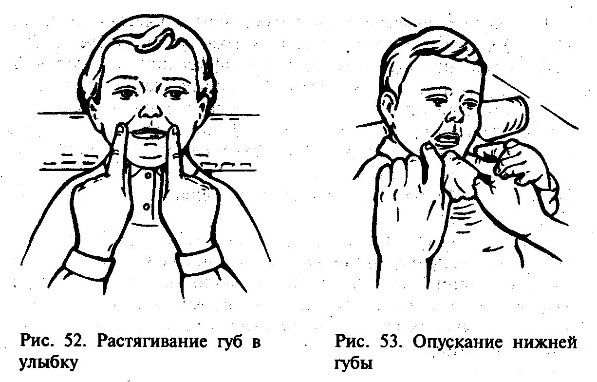 Звуки рта и рук. Пассивная артикуляционная гимнастика для детей с ДЦП. Артикуляционная гимнастика для детей с ДЦП. Артикуляционная гимнастика для детей при дизартрии. Пассивная гимнастика при дизартрии.