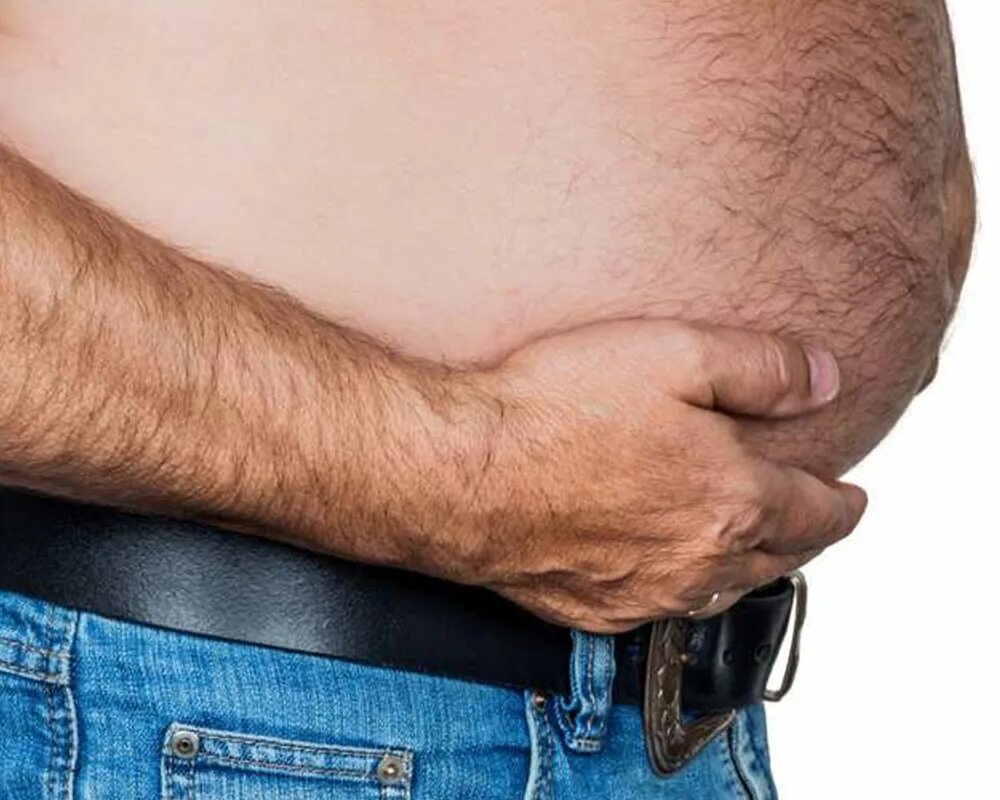 Живот у мужчин после 60. Асцит брюшной полости цирроз печени.