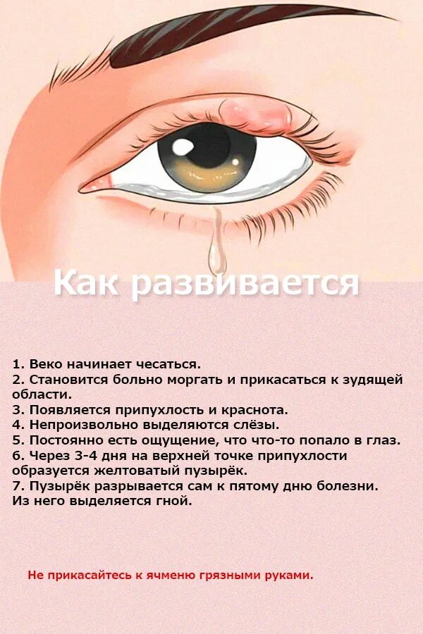 Ячмень лечение народными средствами в домашних. Воспаление века ячмень.