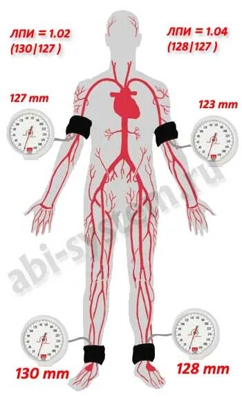 Разница ад на руках. Измерение лодыжечно плечевого индекса тонометрами. Измерение давления на ногах. Артериальное давление на ногах.