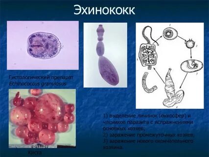Эхинококк это