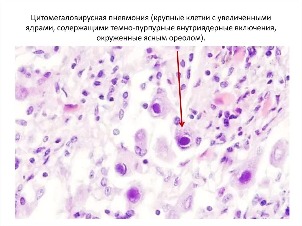 Клетки с несколько увеличенными ядрами