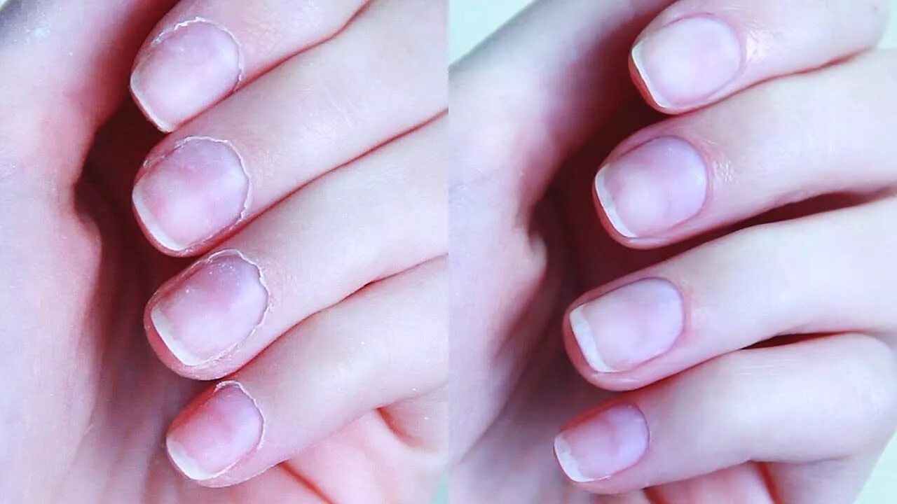 Снятие шеллака. Укрепление ногтей. Куда деть ногти. Красивые ухоженные ногти без лака. Куда деть ногти.