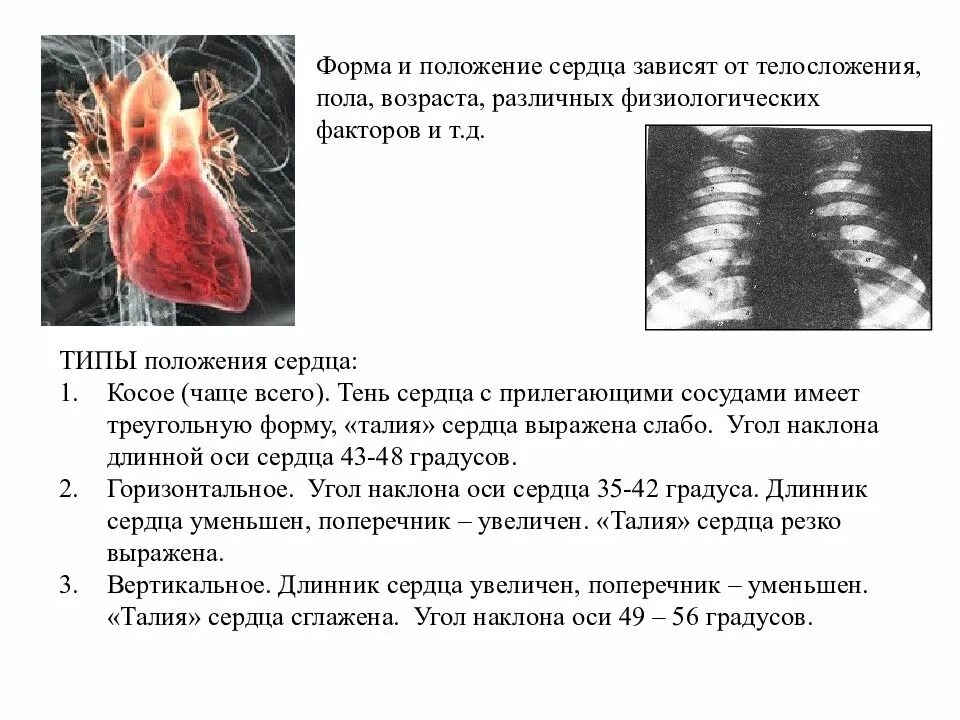 Типы положения сердца. Варианты положения сердца. праворасположенное правосформированное сердце. положение сердца зависит.