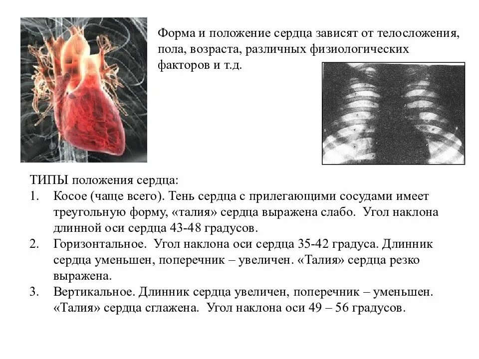 Вертикальная позиция сердца. Форма и положение сердца. Типы положения сердца. Правосформированное праворасположенное сердце. Варианты расположения сердца в зависимости от телосложения.