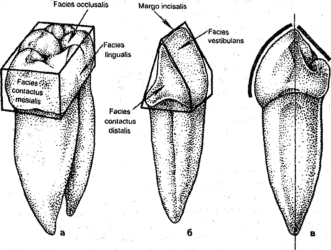 Клыки поверхность зуба. Резец вестибулярная поверхность зуба. Медиальная контактная поверхность зуба. Вестибулярная и медиальная поверхность зуба. Поверхности коронок зубов анатомия.