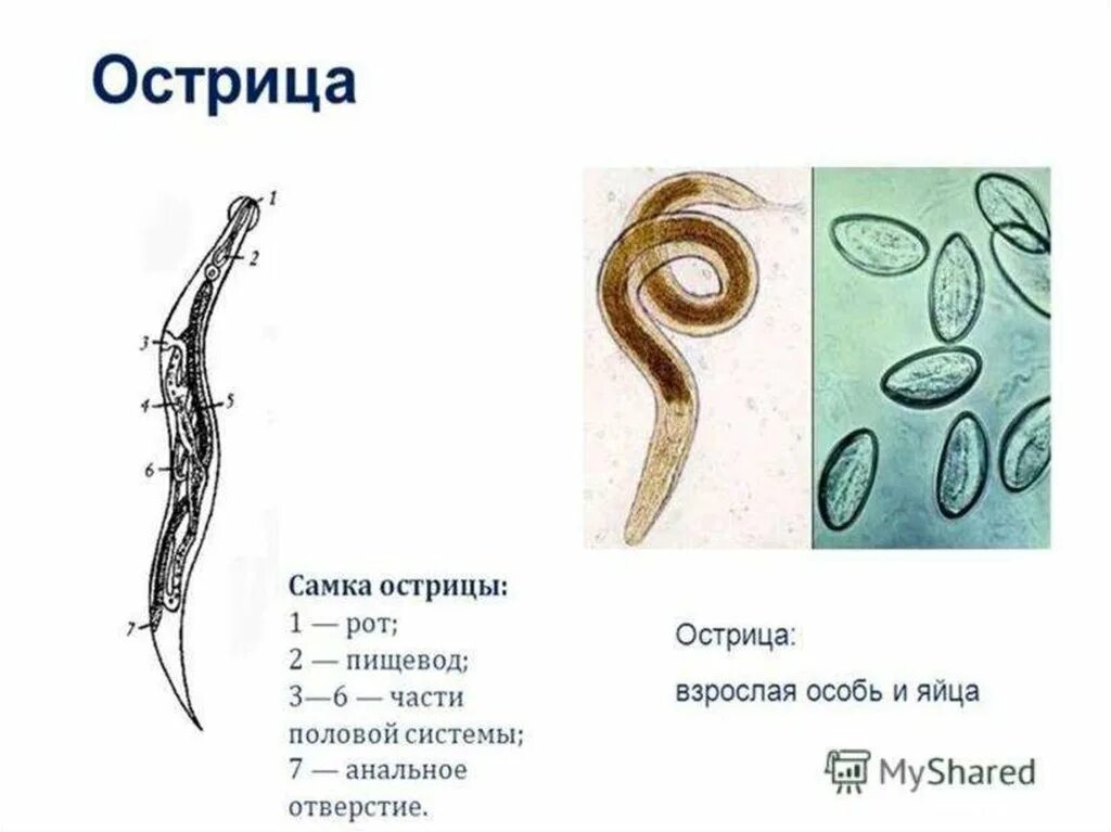 Аскариды, токсокары, острицы.. Острицы, власоглав, аскариды. Острица строение. Энтеробиоз вид гельминта.