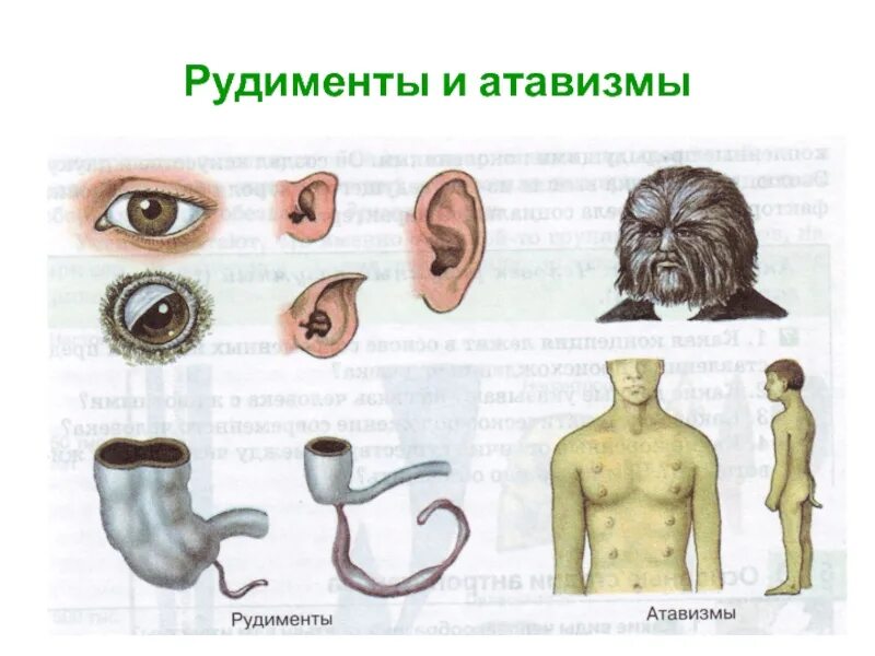 Примерами рудиментов у человека служат. Атавизмы и рудименты человека. атавизмы и рудименты различия.