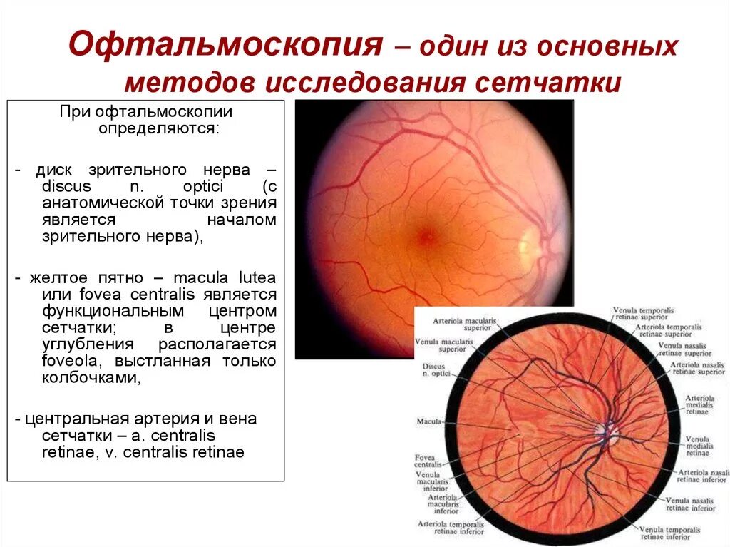 Офтальмоскопия глазного дна. Методы исследования патологии сетчатки и зрительного нерва. Офтальмоскопия глазного дна заключение. Схема глазного дна при обратной офтальмоскопии. Диагноз сетчатки