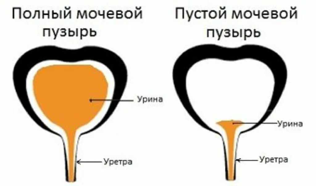 Терпеть мочевой долго. Емкость мочевого пузыря в норме:. Объем мочевого пузыря у женщин в норме. Объем мочевого пузыря у мужчин. Наполнение мочевого пузыря норма.