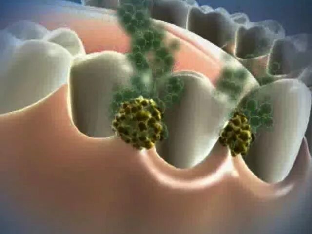 Бактерии которые живут на зубах.