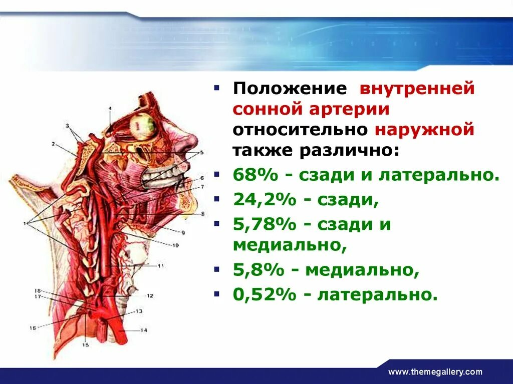 Расположение внутренней сонной артерии. Расположение общей сонной артерии. Сонная артерия расположение. ВСА артерия. Где находится общая сонная артерия