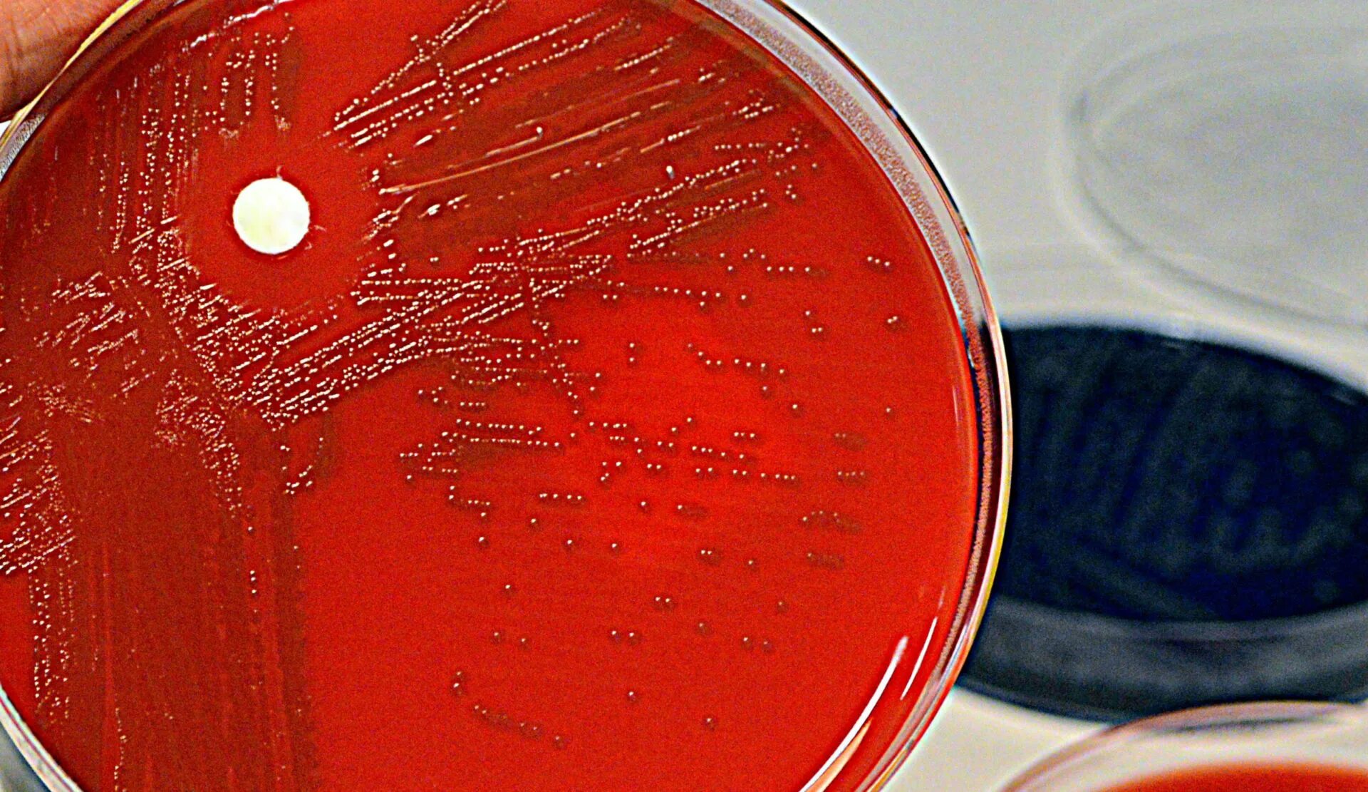 Streptococcus pneumoniae haemophilus influenzae streptococcus. Стрептококки на кровяном агаре. proteus mirabilis на кровяном агаре. автолизин аутолизин streptococcus pneumoniae.