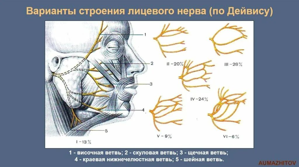 Лицевой нерв анатомия ветви. Топография лицевого нерва топографическая анатомия. Височная ветвь лицевого нерва. Лицевой нерв анатомия топография ветви.