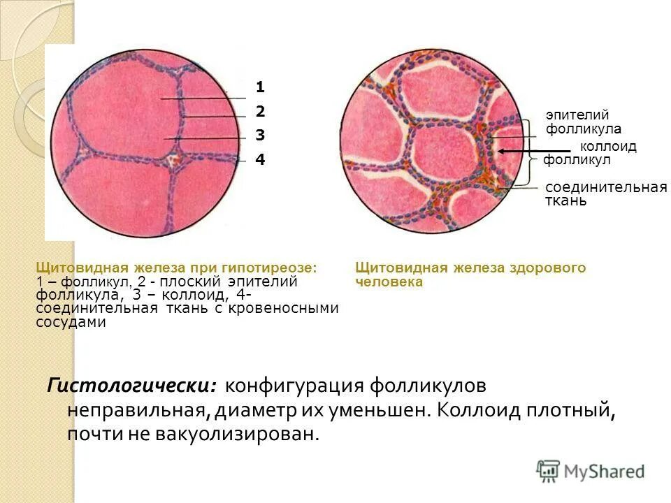 Фолликул щитовидной железы. Коллоид фолликулов щитовидной железы. Фолликулярный эпителий щитовидной железы гистология. Эпителий фолликулов щитовидной железы. Коллоид фолликулов щитовидной железы.