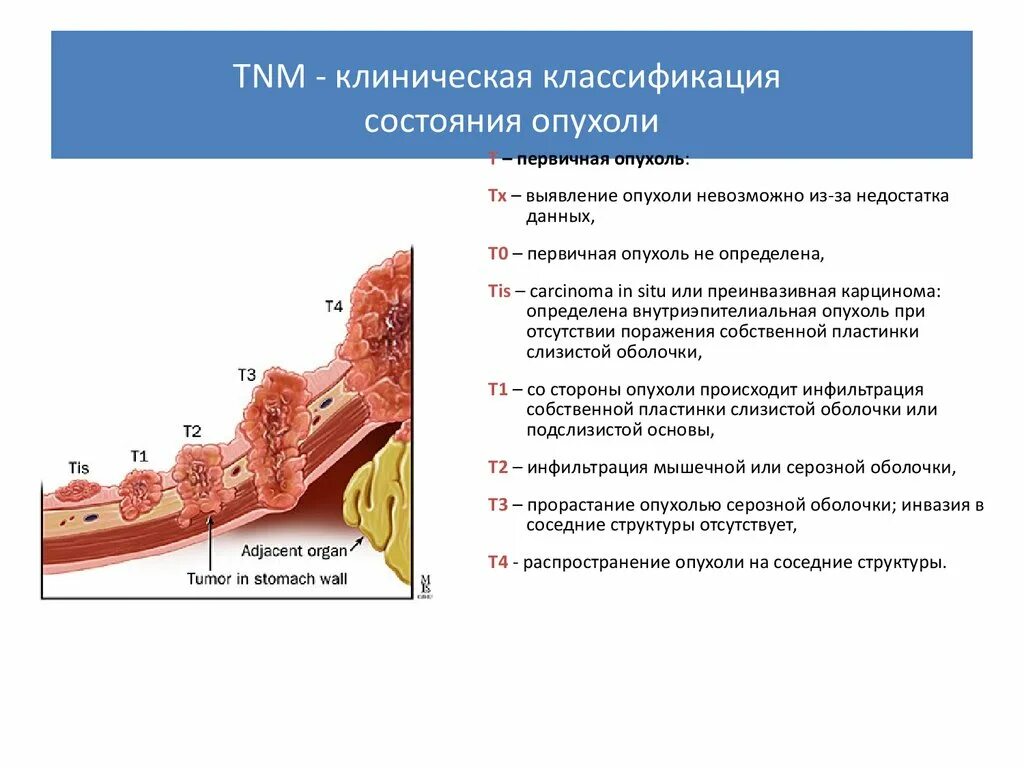 Отсутствие внутриэпителиального поражения или злокачественности