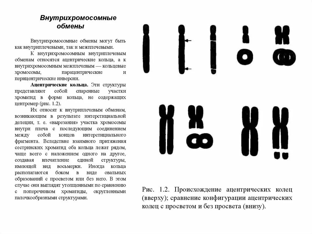 Кольцевая хромосома. Дицентрические и кольцевые хромосомы. Ацентрические ФРАГМЕНТЫ хромосом. Хромосомная аберрация Кольцевая хромосома. Кольцевая 4 хромосома