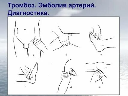 Пульсация периферических артерий