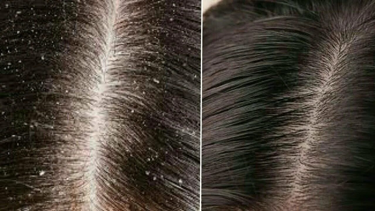 Remove effect. Remove effect