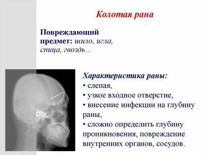 Характеристика ран