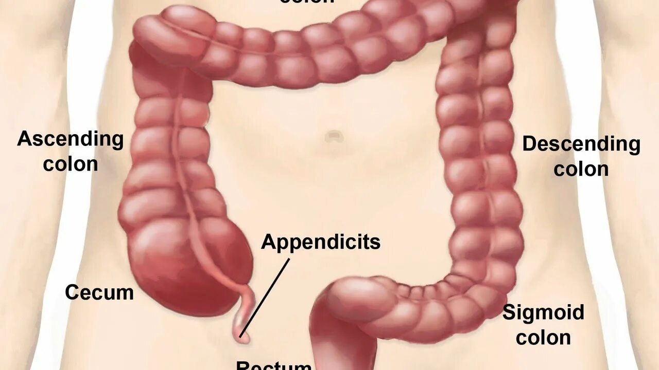 С какой стороны находится аппендикс у мужчин. Расположение аппендицита у человека. Где находится аппендикс у человека.