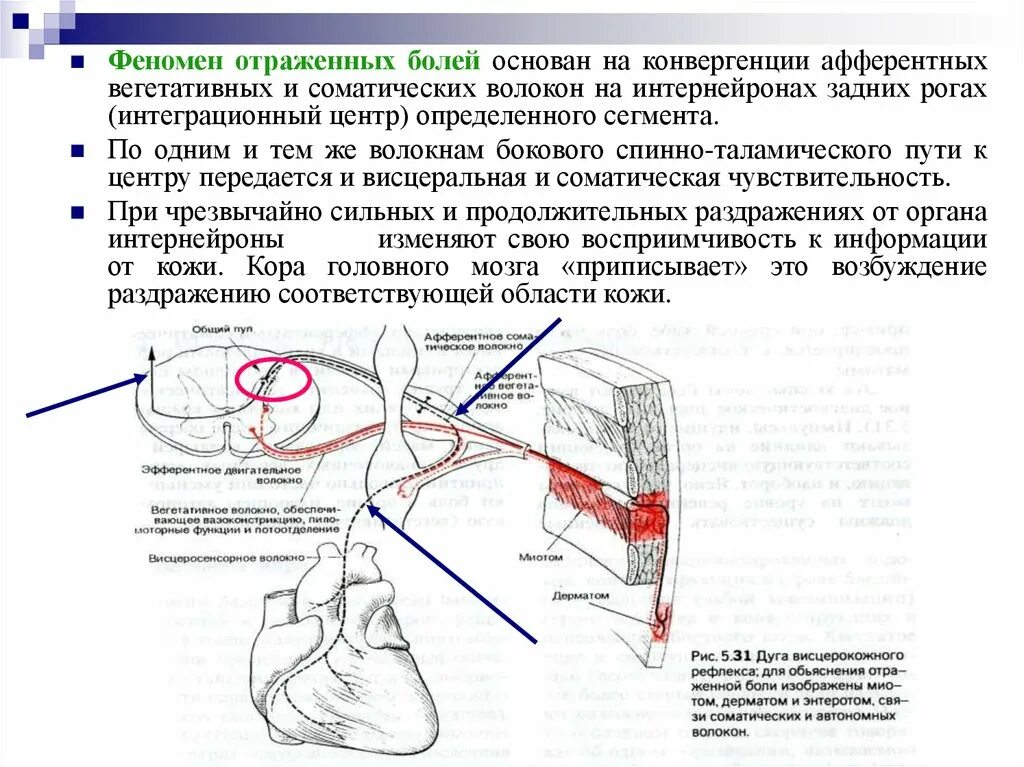 Висцеральный рефлекс. Рефлекс конвергенции физиология. Отраженные боли физиология. Феномен отражения. Афферентные соматические волокна.