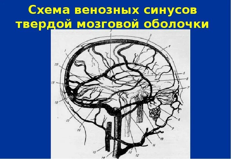 Мозговые венозные синусы. Схема венозных синусов твердой мозговой оболочки. вены головного мозга венозные синусы твердой мозговой оболочки. хирургическая анатомия венозных синусов твердой мозговой оболочки. венозные синусы мозга схема.