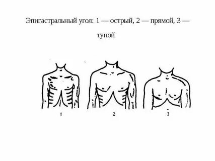 Острый грудной