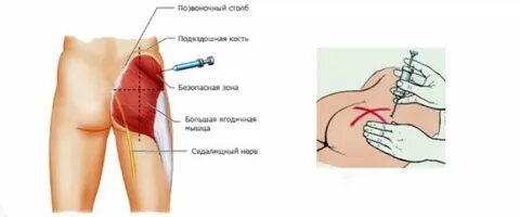 Жалаңаш үнді әйелдері семіз