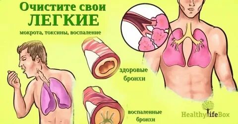 Слизистая мокрота без кашля