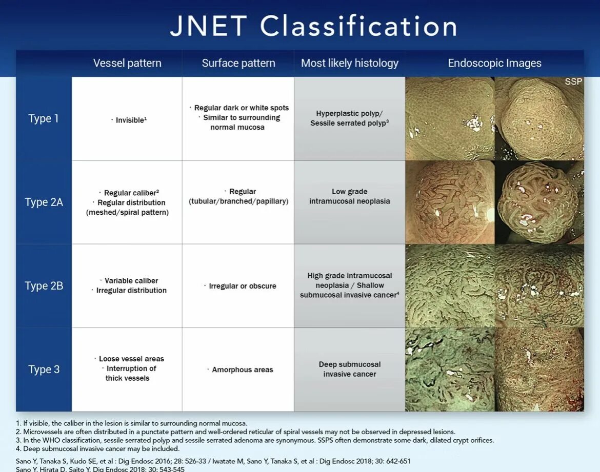 Jnet тип 2а. Jnet классификация. jnet классификация эндоскопия. jnet классификация полип. эндоскопическая классификация полипов.