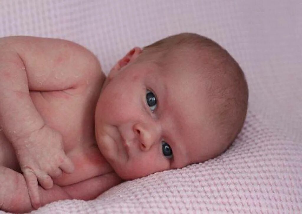 Мраморная кожа у младенца. Мраморная кожа у новорожденного. Мраморная кожа у грудничка. Мраморность кожи у новорожденных.