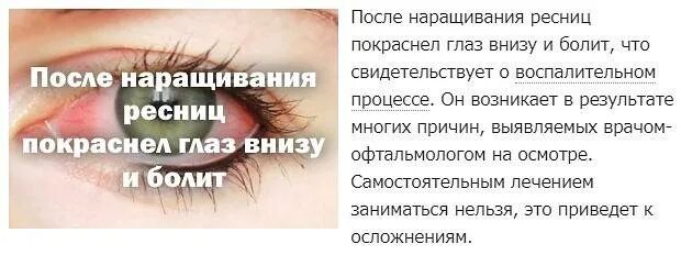 Капли после ресниц. Воспалился глаз после наращивания. Болит глаз после наращивания. Покраснение после наращивания ресниц. Воспаление глаз после наращивания ресниц.