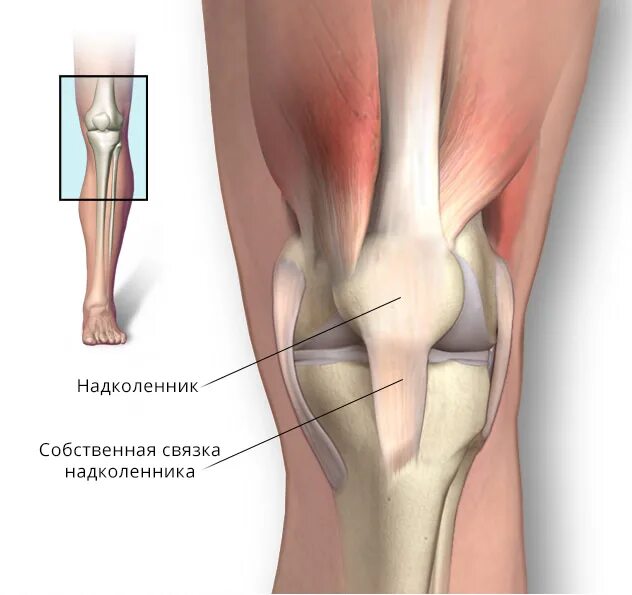 Тендинит коленных связок. Связки надколенника коленного сустава. Надколенник коленного сустава анатомия. Тендинит сухожилия надколенника.