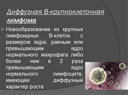 Первичная диффузная лимфома