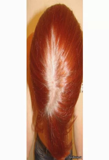 Кислотная смывка матрикс. Смывка рыжего цвета с волос. Как смыть рыжий цвет волос. Как смыть рыжий цвет волос. Как смыть рыжий цвет волос.
