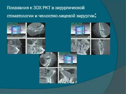 Мрт челюстно лицевой