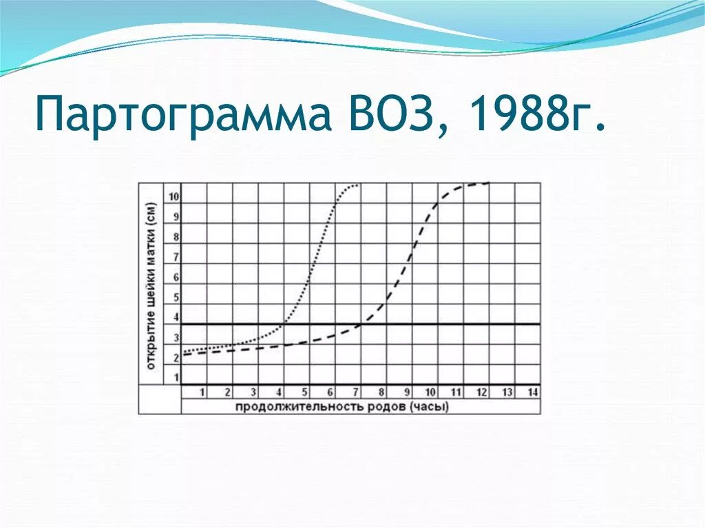 Партограмма нормальных родов. Партограмма. Партограмма в акушерстве. Партограмма повторнородящей. Партограмма.