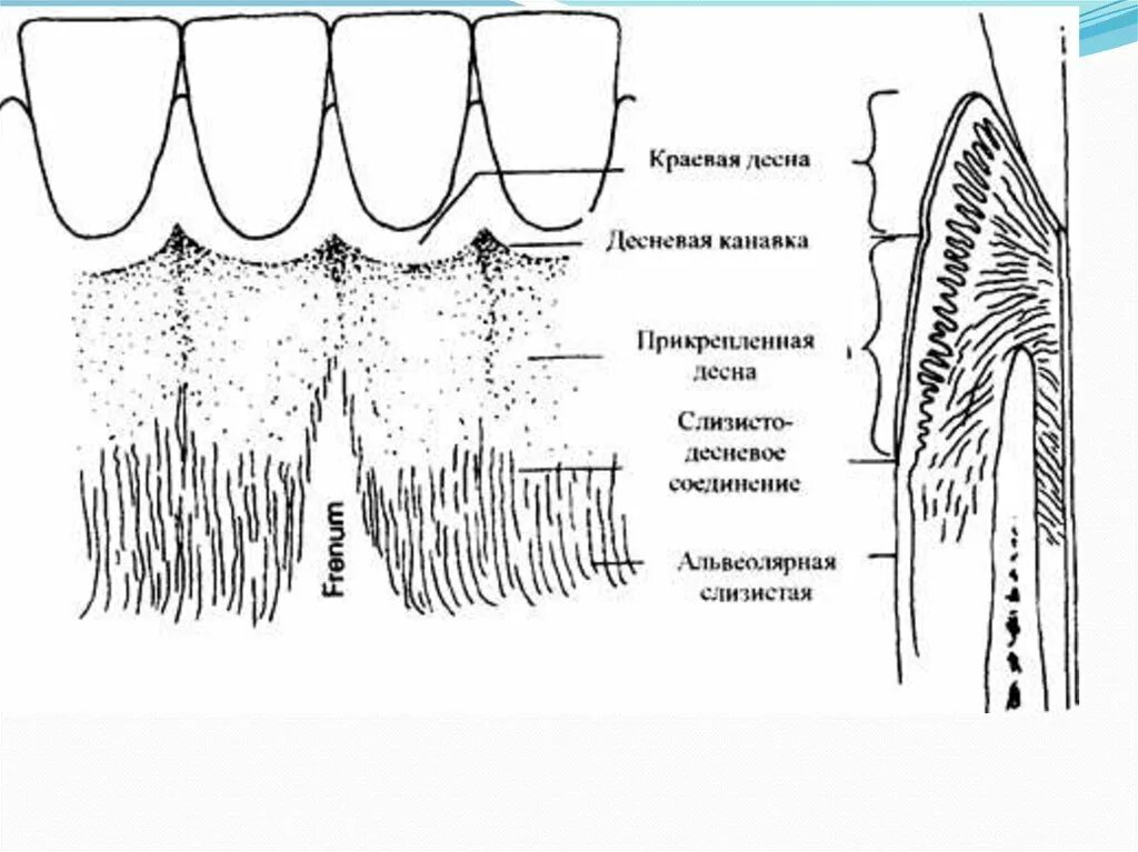 Схема десен. Эпителий прикрепления десны гистология. Маргинальный периодонт. Прикрепленная свободная Десна альвеолярная. Маргинальная и альвеолярная Десна.