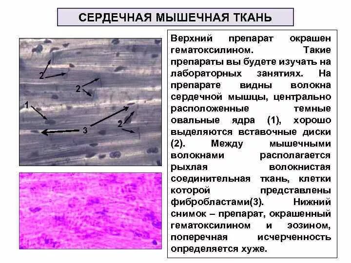 Поперечно полосатая сердечная мышечная ткань гистология препарат. Поперечно полосатая сердечная ткань гистология. Сердечная поперечно-полосатая мускулатура препарат. Поперечнополосатая сердечная мышечная ткань препарат. Препарат поперечно полосатая мышечная ткань