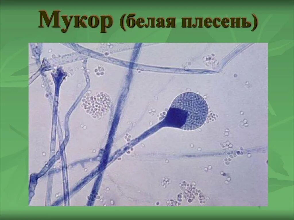 Царство гриба мукор. Строение клетки мукора. плесень гриб мукор. белая плесень мукор. клетка плесени мукора.