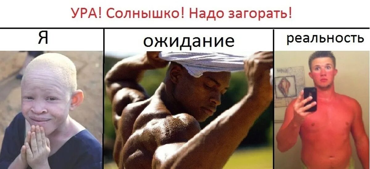 Загорело над ебалом. Загорать на солнце. Прикольные картинки загорающих. Мемы про сгоревшую кожу. Линии от загара.