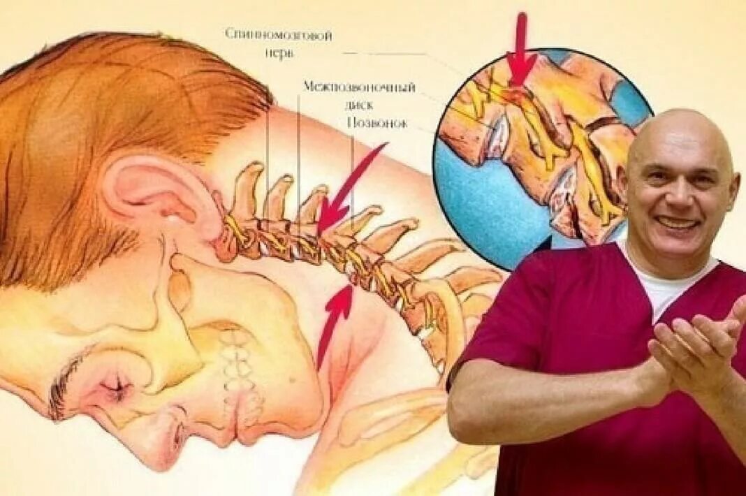 Хрустит затылок. Защемление шеи упражнения. Боль в шейном отделе.