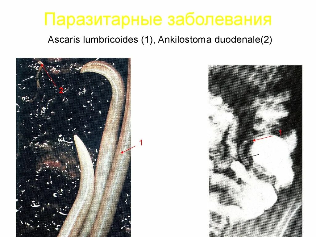 Основные паразитарные заболевания. Паразитарные заболевания. Паразитарные заболевания презентация. Паразитарные заболевания костей. Симптомы паразитарных заболеваний у человека.